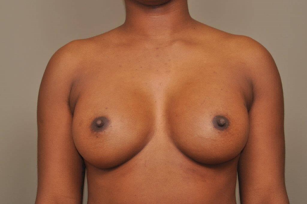 After Image