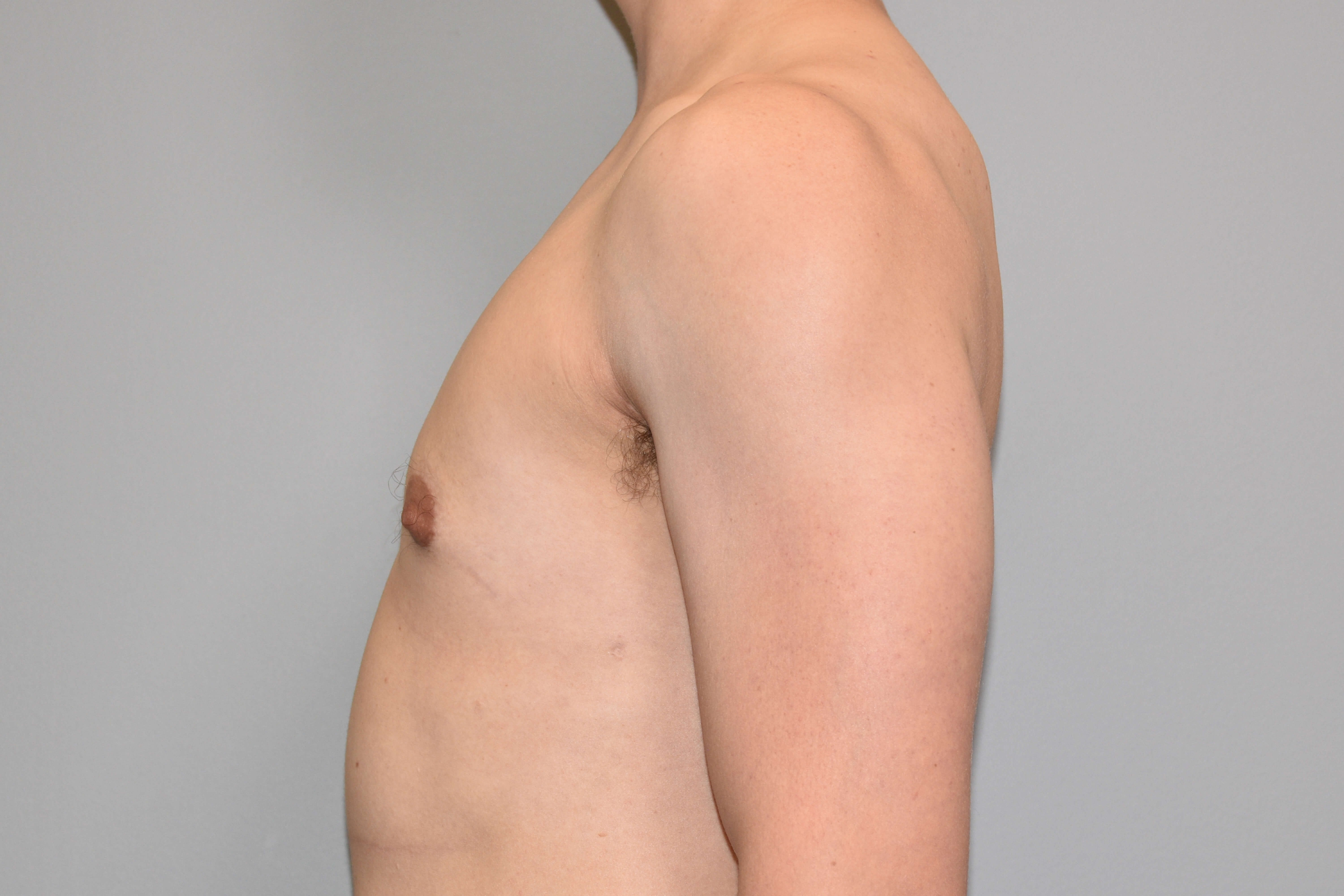 Female to Male side view After