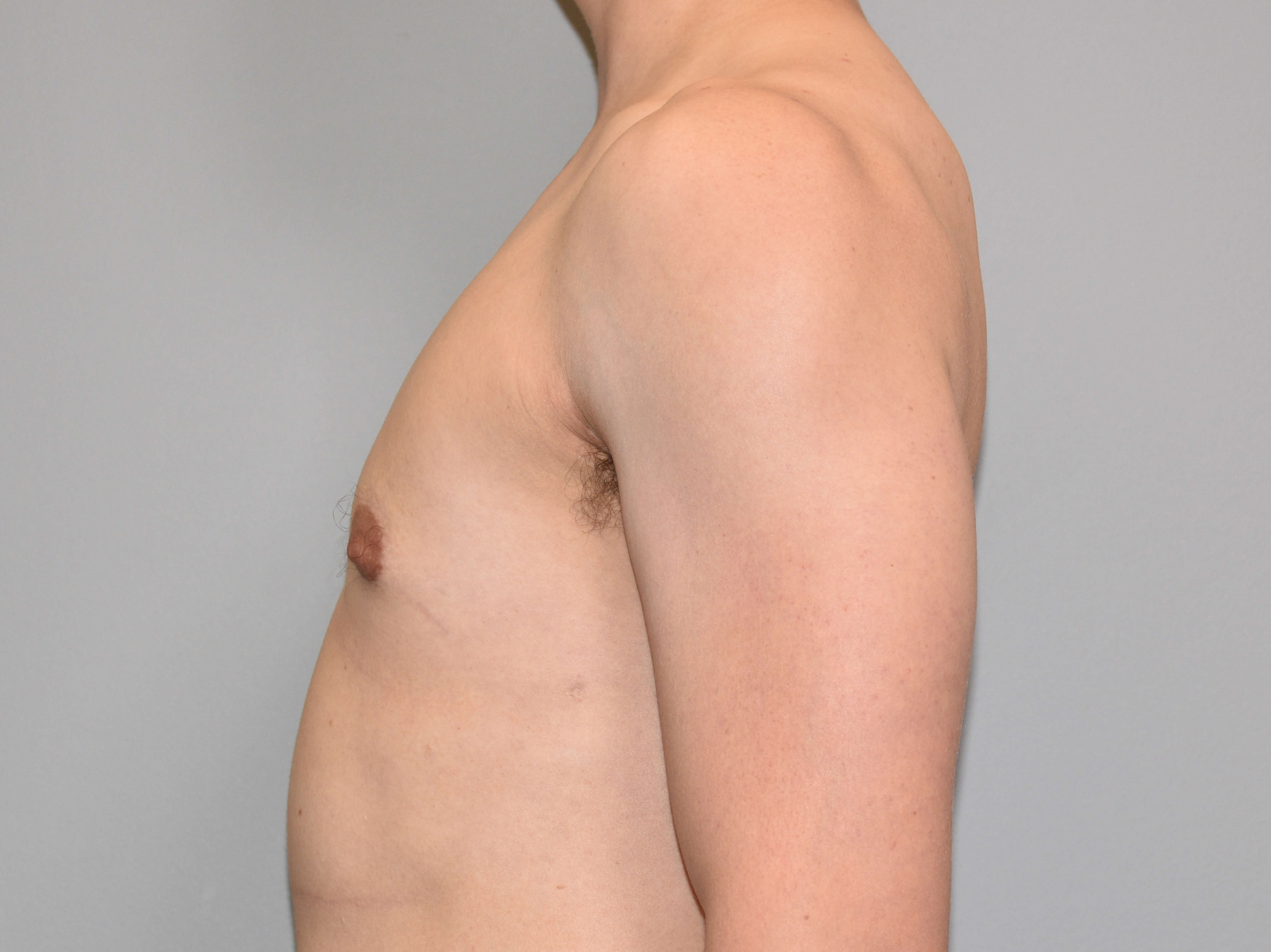 Female to Male side view After