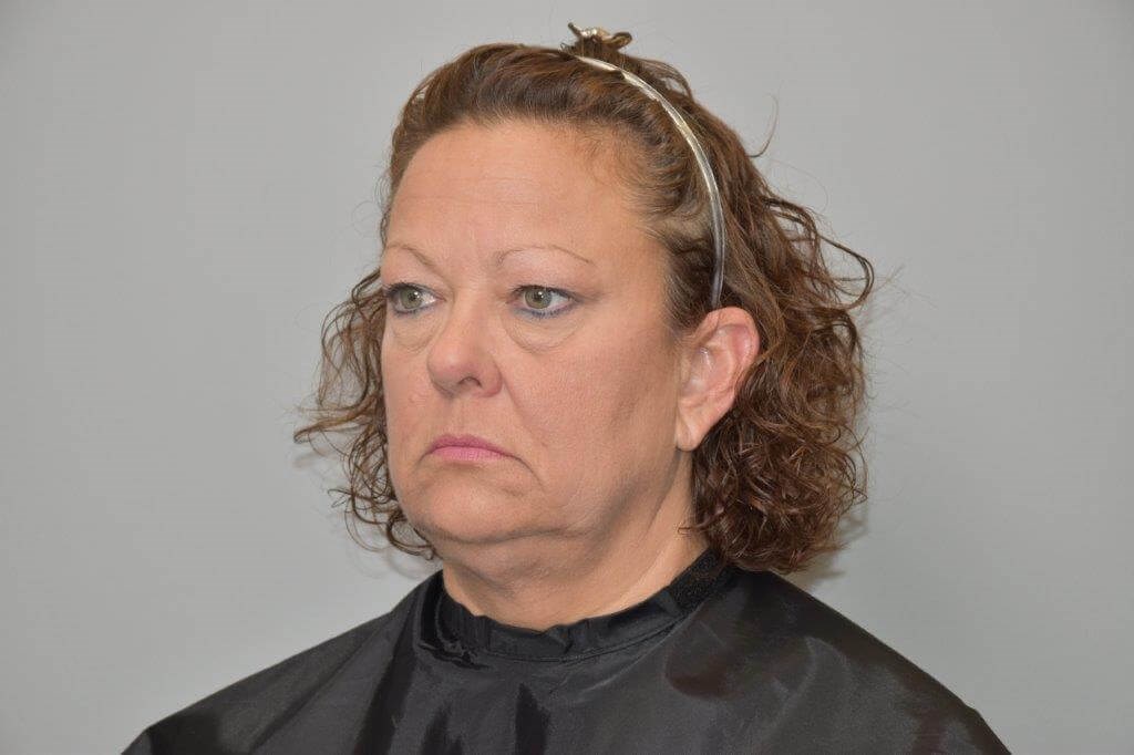 Facelift Left Angled View Before