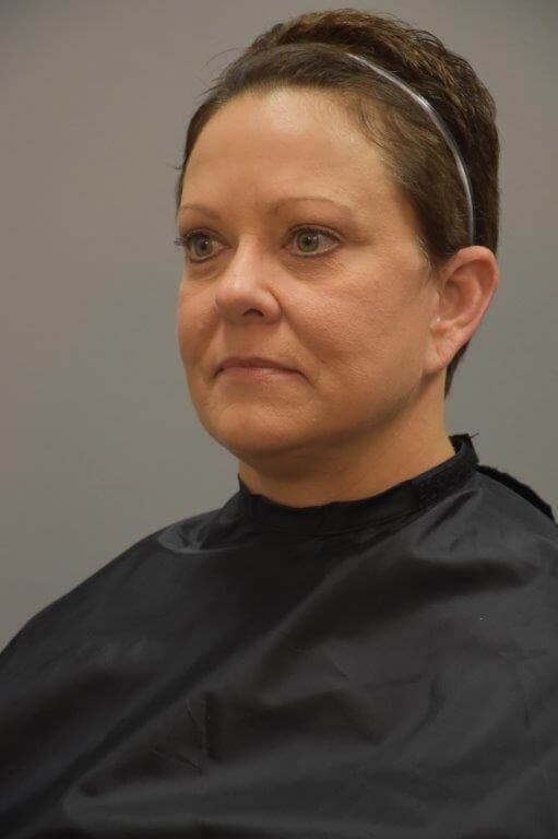 Facelift Left Angled View After